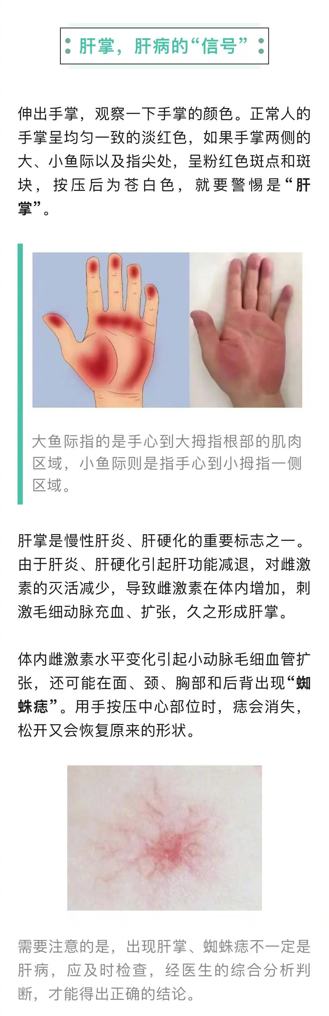震惊！看手就能知道肝好不好！医生不愿透露的5个肝脏信号