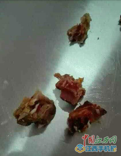 震惊！绞肉机有蛆虫学校又被曝饮用水偏黄，家长怒斥：孩子健康谁来保障？